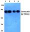 Cortactin antibody, A01253Y466, Boster Biological Technology, Western Blot image 