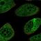 Nfl antibody, NBP2-58699, Novus Biologicals, Immunofluorescence image 