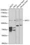 Wolframin ER Transmembrane Glycoprotein antibody, 16-845, ProSci, Western Blot image 