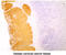 Keratin 14 antibody, GTX57611, GeneTex, Immunohistochemistry paraffin image 