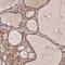 Leucine Rich Repeat Containing 43 antibody, NBP2-14201, Novus Biologicals, Immunohistochemistry paraffin image 