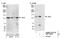 Janus Kinase 2 antibody, NBP1-22975, Novus Biologicals, Western Blot image 