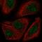 TOX High Mobility Group Box Family Member 2 antibody, HPA058396, Atlas Antibodies, Immunofluorescence image 