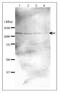 Double-strand-break repair protein rad21 homolog antibody, GTX00890, GeneTex, Western Blot image 