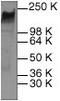 ERBB2 antibody, GTX22428, GeneTex, Western Blot image 