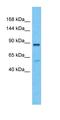 Serine/threonine-protein kinase D3 antibody, orb327363, Biorbyt, Western Blot image 