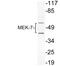 Mitogen-Activated Protein Kinase Kinase 7 antibody, LS-C177780, Lifespan Biosciences, Western Blot image 