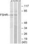 Follicle-stimulating hormone receptor antibody, abx015281, Abbexa, Western Blot image 