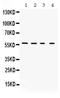 Potassium Voltage-Gated Channel Subfamily A Member 2 antibody, PB9649, Boster Biological Technology, Western Blot image 