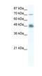 DExD-Box Helicase 50 antibody, NBP1-57289, Novus Biologicals, Western Blot image 