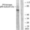 Phosphoinositide-3-Kinase Regulatory Subunit 1 antibody, PA5-38904, Invitrogen Antibodies, Western Blot image 