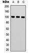 Mediator Complex Subunit 24 antibody, orb315609, Biorbyt, Western Blot image 