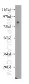 CD164 Molecule antibody, 12083-2-AP, Proteintech Group, Western Blot image 