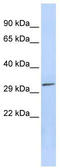 Pyridoxal Phosphatase antibody, TA344797, Origene, Western Blot image 