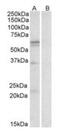 Solute Carrier Family 7 Member 5 antibody, orb20330, Biorbyt, Western Blot image 