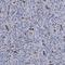 Solute Carrier Family 28 Member 3 antibody, NBP1-84417, Novus Biologicals, Immunohistochemistry frozen image 