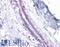 Cadherin 1 antibody, LS-B4674, Lifespan Biosciences, Immunohistochemistry paraffin image 