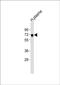 Insulin Like Growth Factor Binding Protein Acid Labile Subunit antibody, PA5-72431, Invitrogen Antibodies, Western Blot image 