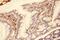 Matrix Metallopeptidase 7 antibody, PA5-79686, Invitrogen Antibodies, Immunohistochemistry paraffin image 