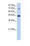 Splicing Factor 3b Subunit 4 antibody, NBP1-57419, Novus Biologicals, Western Blot image 