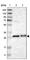 Transmembrane P24 Trafficking Protein 1 antibody, HPA018507, Atlas Antibodies, Western Blot image 