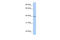 Alpha-1,3-mannosyl-glycoprotein 4-beta-N-acetylglucosaminyltransferase-like protein LOC641515 antibody, 26-388, ProSci, Western Blot image 