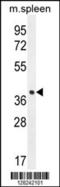 Tetraspan membrane protein of hair cell stereocilia antibody, 55-170, ProSci, Western Blot image 