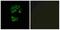 GTPase, IMAP Family Member 2 antibody, A30710, Boster Biological Technology, Immunohistochemistry paraffin image 