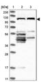 Family With Sequence Similarity 83 Member G antibody, NBP1-93771, Novus Biologicals, Western Blot image 
