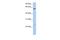 Protein FAM3C antibody, TA335977, Origene, Western Blot image 