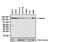 Bone Morphogenetic Protein Receptor Type 2 antibody, MA5-15827, Invitrogen Antibodies, Western Blot image 