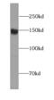 FA Complementation Group D2 antibody, FNab03007, FineTest, Western Blot image 