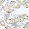 Coenzyme Q7, Hydroxylase antibody, A7768, ABclonal Technology, Immunohistochemistry paraffin image 