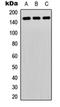 1-phosphatidylinositol-4,5-bisphosphate phosphodiesterase gamma-2 antibody, orb256753, Biorbyt, Western Blot image 