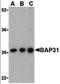B Cell Receptor Associated Protein 31 antibody, orb86684, Biorbyt, Western Blot image 