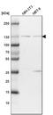 Bifunctional protein NCOAT antibody, HPA036141, Atlas Antibodies, Western Blot image 