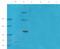 Integrin Subunit Alpha 6 antibody, orb6246, Biorbyt, Western Blot image 