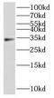 Homeobox D11 antibody, FNab03984, FineTest, Western Blot image 