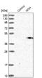 Gamma-glutamyl hydrolase antibody, NBP1-90927, Novus Biologicals, Western Blot image 