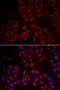 Metadherin antibody, orb373298, Biorbyt, Immunofluorescence image 