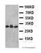 Dickkopf WNT Signaling Pathway Inhibitor 1 antibody, orb27676, Biorbyt, Western Blot image 
