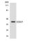 Sphingosine 1-phosphate receptor 2 antibody, LS-C291905, Lifespan Biosciences, Western Blot image 