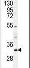Family With Sequence Similarity 78 Member B antibody, PA5-24185, Invitrogen Antibodies, Western Blot image 