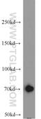 Growth Factor Receptor Bound Protein 10 antibody, 23591-1-AP, Proteintech Group, Western Blot image 