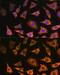 Pyruvate Dehydrogenase E1 Alpha 2 Subunit antibody, GTX66319, GeneTex, Immunocytochemistry image 