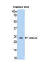Alpha-N-Acetylgalactosaminidase antibody, LS-C302004, Lifespan Biosciences, Western Blot image 