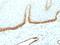Podoplanin antibody, M01124, Boster Biological Technology, Immunohistochemistry paraffin image 