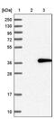 Thioredoxin Related Transmembrane Protein 2 antibody, PA5-59133, Invitrogen Antibodies, Western Blot image 