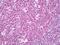 Adhesion Regulating Molecule 1 antibody, orb95825, Biorbyt, Immunohistochemistry paraffin image 