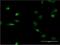 Lamin B1 antibody, H00004001-M03, Novus Biologicals, Immunofluorescence image 